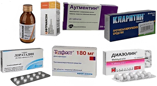 Разные антигистаминные препараты